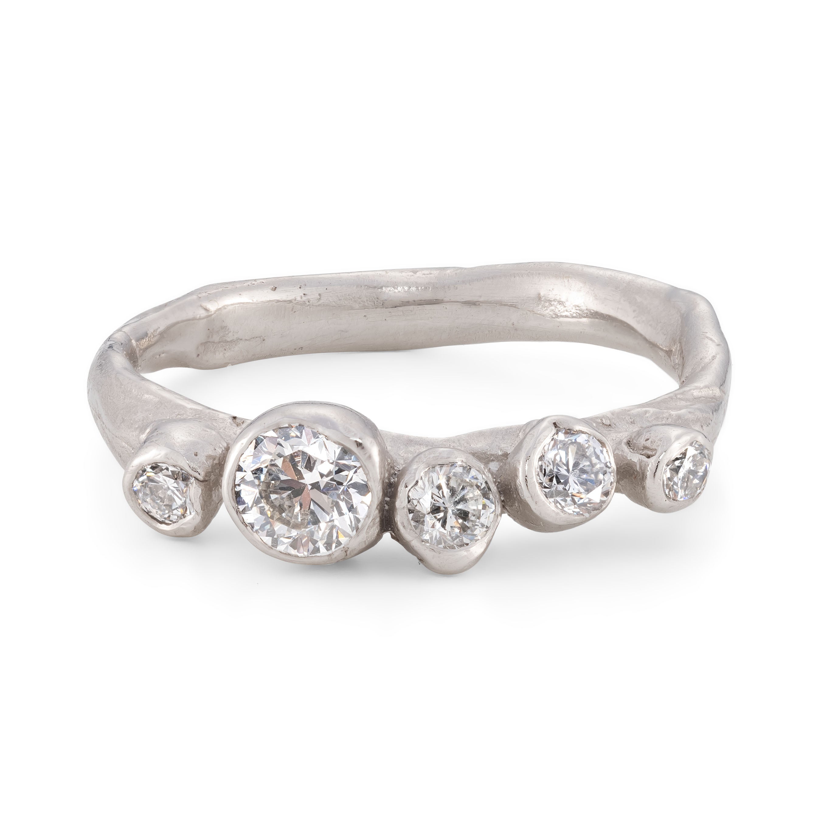 Kidney stone engagement clearance ring